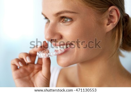 Orthodontics. Closeup Of Beautiful Happy Smiling Woman With White Smile, Straight Teeth Holding Whitening Tray, Invisible Braces, Teeth Trainer. Dental Treatment, Health Concept. High Resolution Image