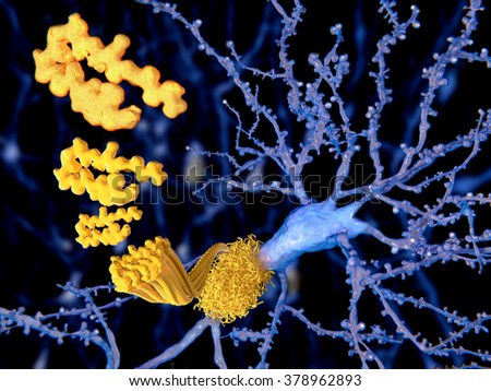 The beta amyloid peptid, amyloid plaques growing on a neuron.\
It consists of about 30 amino acids and aggregates to amyloid plaques, that may damage and kill neurons.