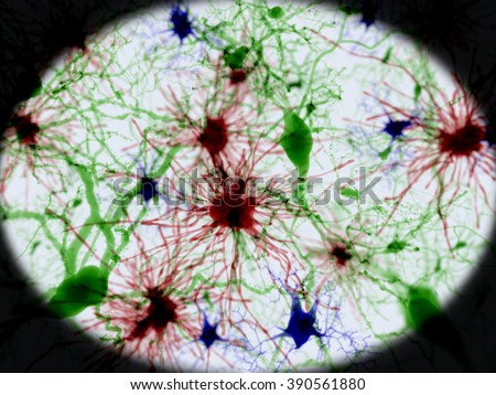 Brain cells.\
Green: pyramidal neurons, red: astrocytes, blue: microglia cells.