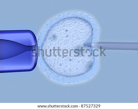In vitro Fertilisation