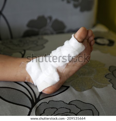 Gauze bandage the foot