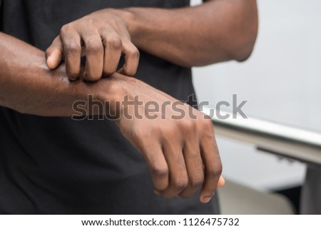 man suffering from itching skin; sick african man scratching his skin with allergy, rash, ringworm, tinea problem; health care, skin care, dermatology concept; adult african man, black man model