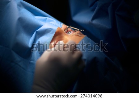 Eye surgery, closeup view of an open patient\'s eye