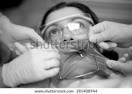 Dental patient face while dentists placing a rubber-dam