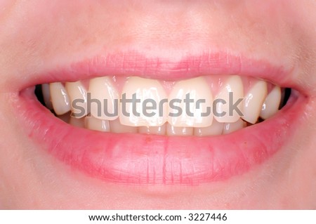 Perfect teeth