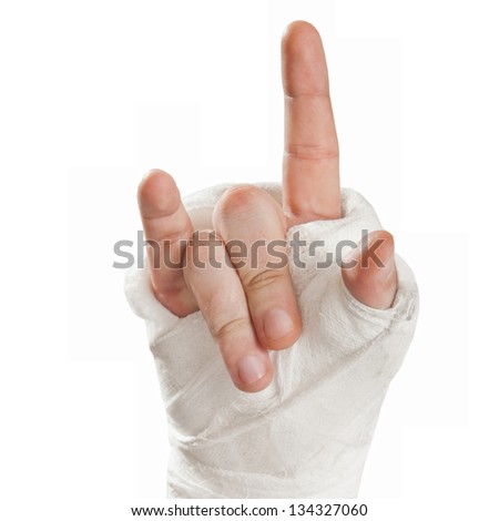 Broken arm in a cast on a white background. Fingers show character punks