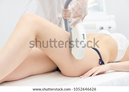 Elos Laser Legs Hair Removal. Epilation Treatment In Cosmetic Beauty Clinic.