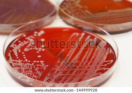 Colonies of Gram negative bacteria growing on the culture plate.