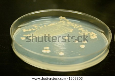 Bacteria culture