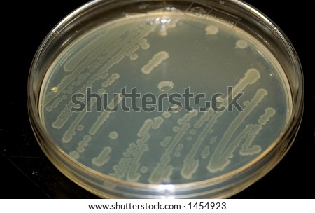 bacterial culture on a petri plate