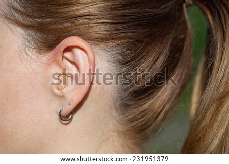 Girl with a hearing aid. hearing aid in the ear close up