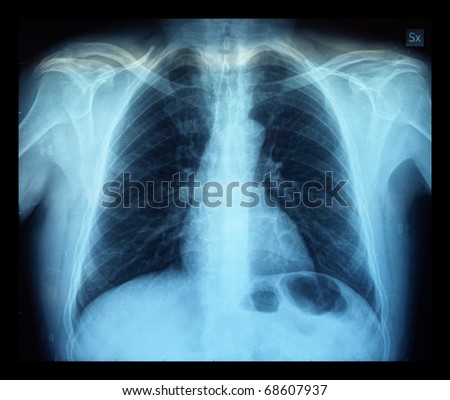 Human X Ray