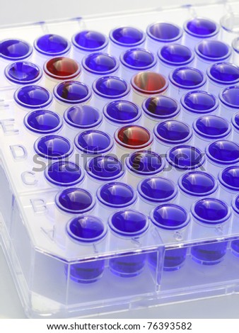 96-well microtiter plate for medical diagnostics and life science research filled with blue and read fluid