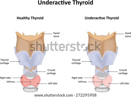 Underactive Thyroid Gland