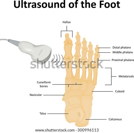 Ultrasound Scan of the Foot Bones