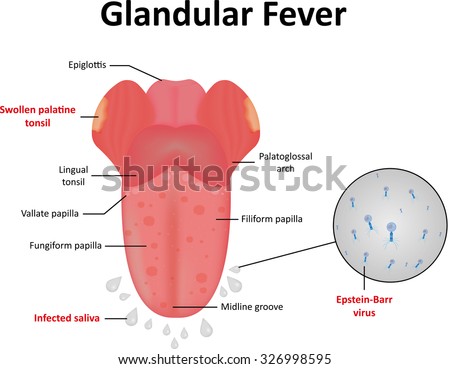 Weight Loss During Glandular Fever Test