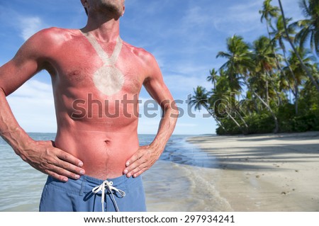 Sunburned athlete standing with outline of medal on empty Brazilian beach