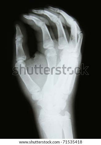 bones at x-rays lights