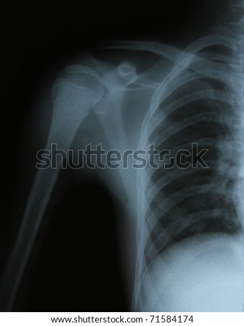 bones at x-rays lights