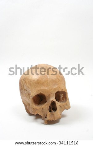 Damaged Skull