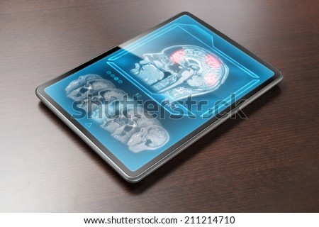 Tablet displaying cerebral activity