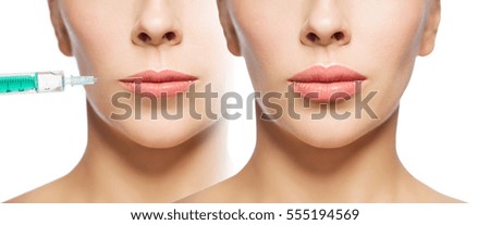 people, cosmetology, plastic surgery and beauty concept - beautiful young woman face before and after lips augmentation injection over white background