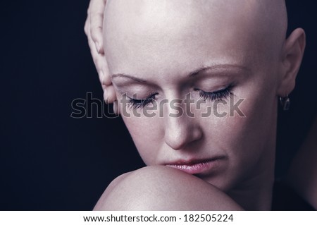Portrait of a young bald-headed girl in studio