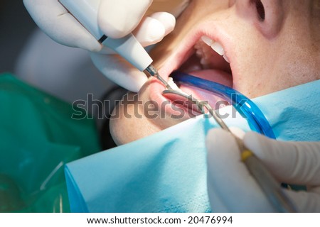 Dentist performing a scan on his patient with specialized tools