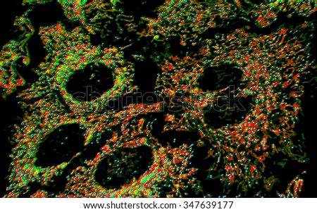 Mitochondria in HeLa cervical cancer cells.
