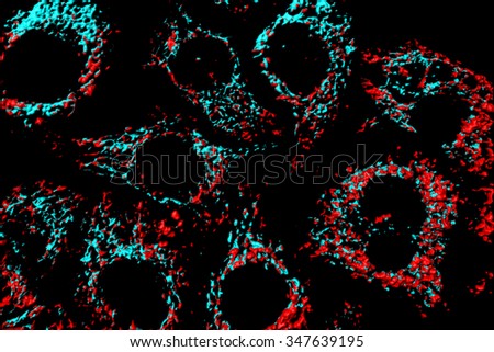 Mitochondria in HeLa cervical cancer cells.