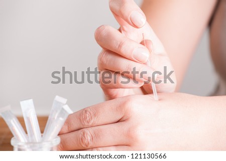 Hand applying acupuncture needle in a point called Hegu.