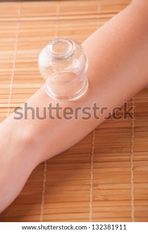 Cupping glass used on acupuncture point on the hand