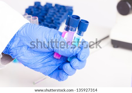Lab technician working with equipment: microscope, test tubes  filled with colored fluid, chemical flasks