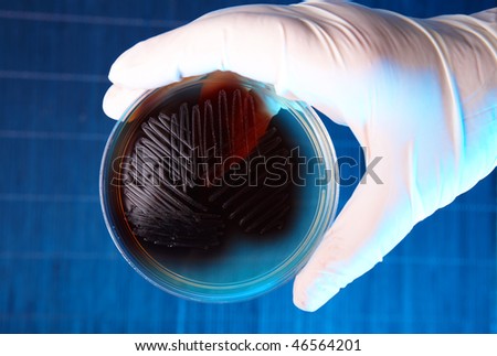 Hand in glove holding Petri plate with bacteria Enterococcus Faecalis