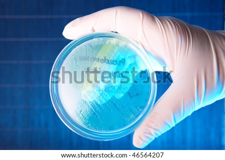 Hand in glove holding Petri plate with bacteria Pseudomonas Aeruginosa