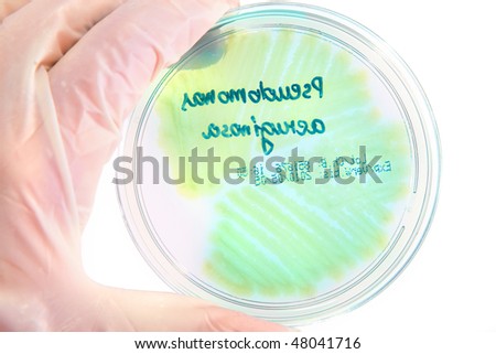 Hand in glove holding Petri plate with bacteria Pseudomonas Aeruginosa