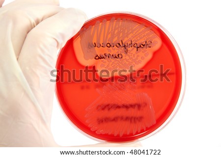 Hand in glove holding Petri plate with bacteria Staphylococcus Aureus, Moraxella Catarrhalis isolated over white background