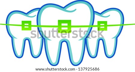 dental braces dental braces