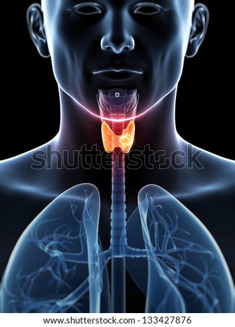 3D rendered illustration of a thyroid cancer 3D rendered illustration of a thyroid cancer