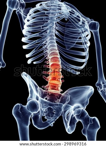 medically accurate illustration - painful lumbar spine