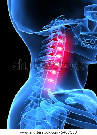 neck pain neck pain