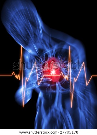 Heart Attack. stock photo : heart attack