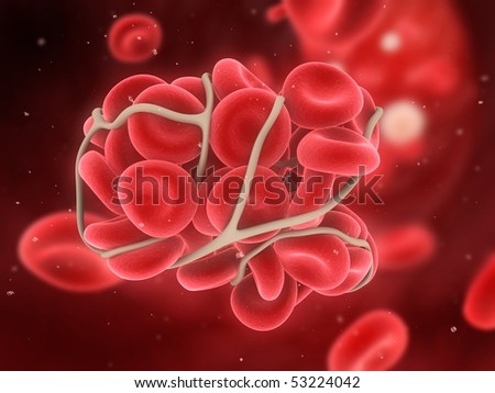 blood clot blood clot
