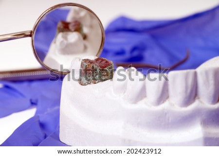 Mouth mirror and model of a human teeth / dental health