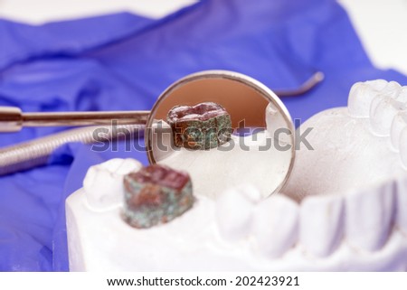 Mouth mirror and model of a human teeth / dental health