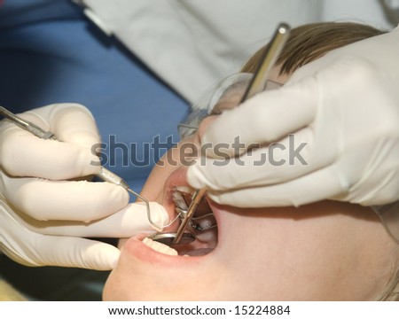 Close-up of a child getting a dental check-up