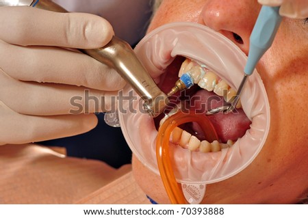 Photo of patient having his teeth healed.
