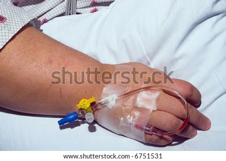 A hospital medical patient with an IV.