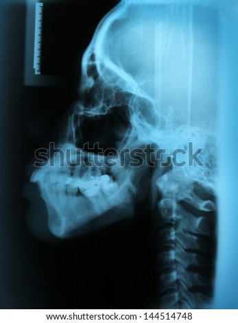 Abstract of human skull on teeth and cervical spine structure for dental clinic background