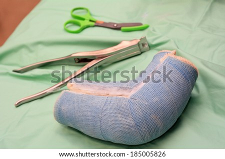Removed child arm cast on hospital bed.. Concept photo of child, children, health care, risk, danger, outdoor accidents, game accidents, playground accidents, home accidents.